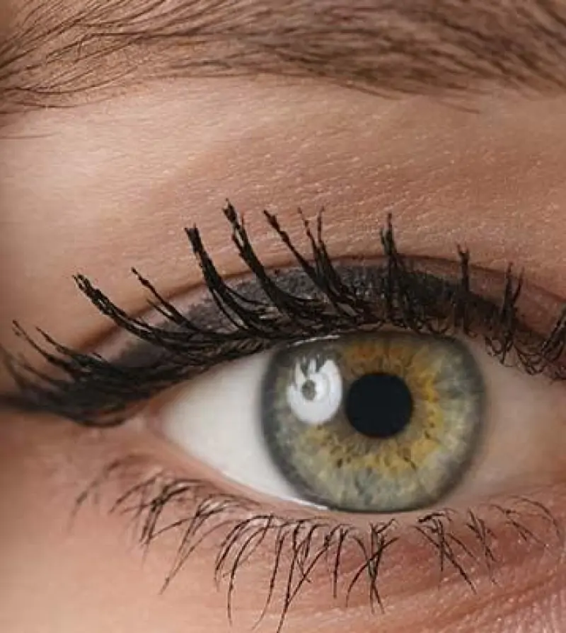 Blefaroplastia em SP (Cirurgia das Pálpebras)