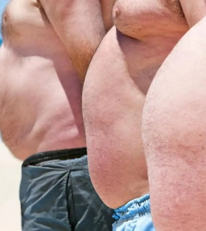 Cirurgia de Ginecomastia na Clínica SER