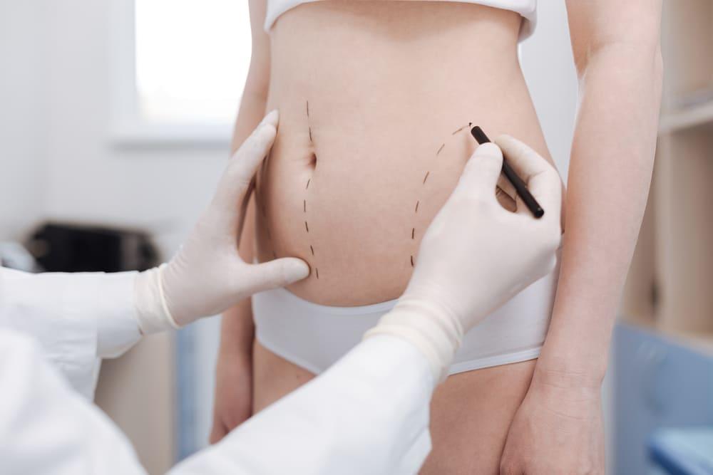 Saiba tudo sobre o procedimento de Lipo LAD