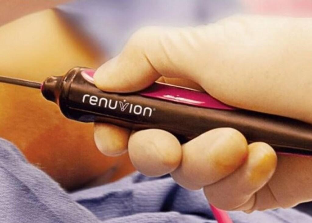 Confira as principais informações sobre a lipo com Renuvion! Confira as principais informações sobre a lipo com Renuvion!