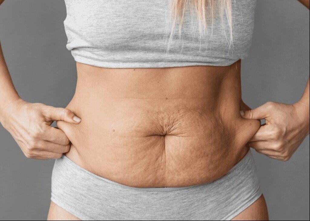 Diferença entre flacidez tissular e muscular: entenda os detalhes!