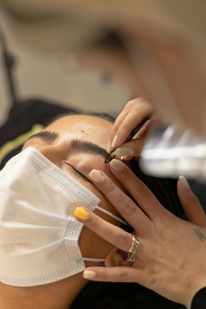 Alopecia na sobrancelha: entenda por que isso ocorre e quais são os tratamentos disponíveis